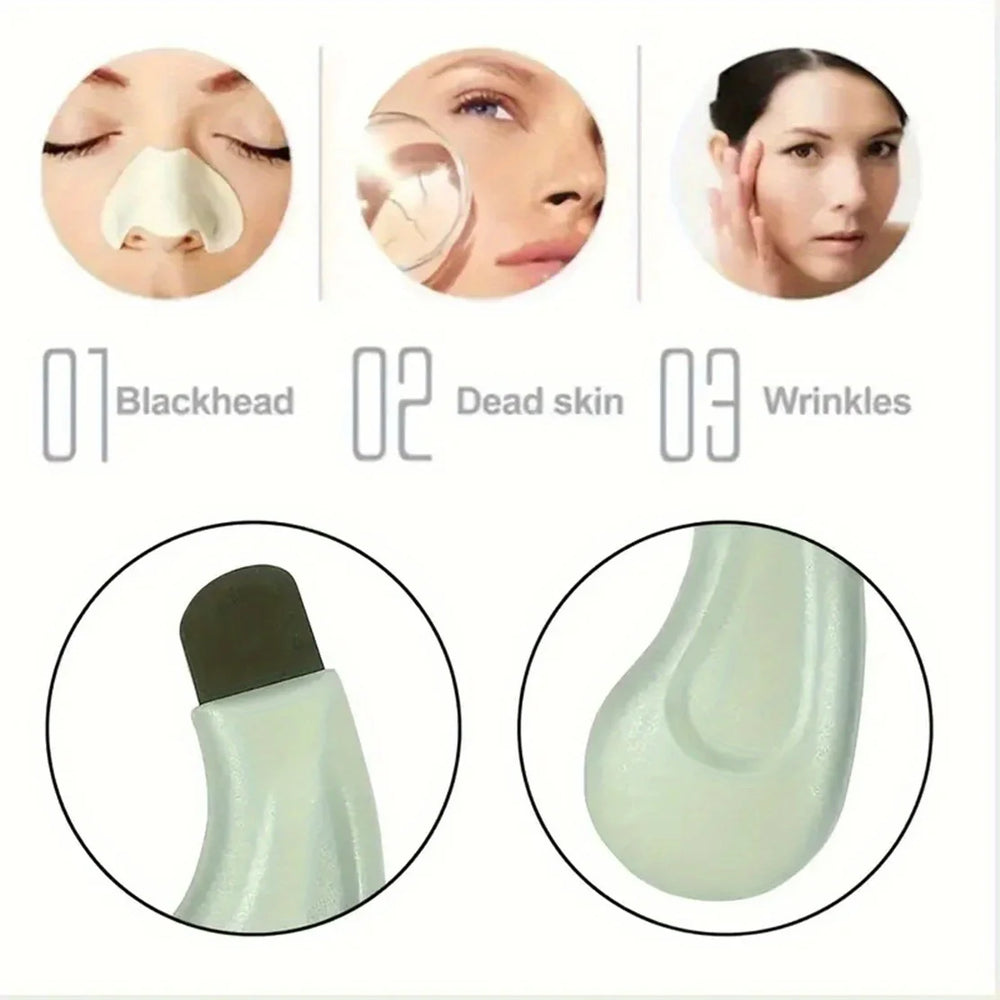 Facial Blackhead Removal Tool | Nose Deep Cleansing Skincare Tool close-up view
