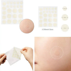 24 Pcs Hydrocolloid Acne Patches | Pimple Spot Treatment Stickers for Face alternate view