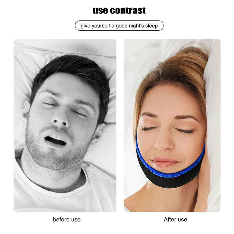 Breathable Anti Snore Chin Strap | Nylon Elastic Mouth Breathing Band for Better Sl additional angle