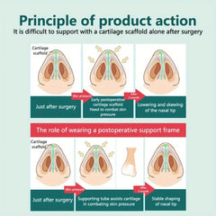 Anti Snore Nose Clip | Soft Silicone Nasal Dilator for Quiet Sleep close-up view