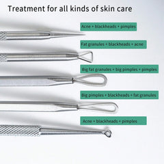 Stainless Steel Blackhead Remover Tool Kit | Professional Facial Cleanser Set with St alternate view