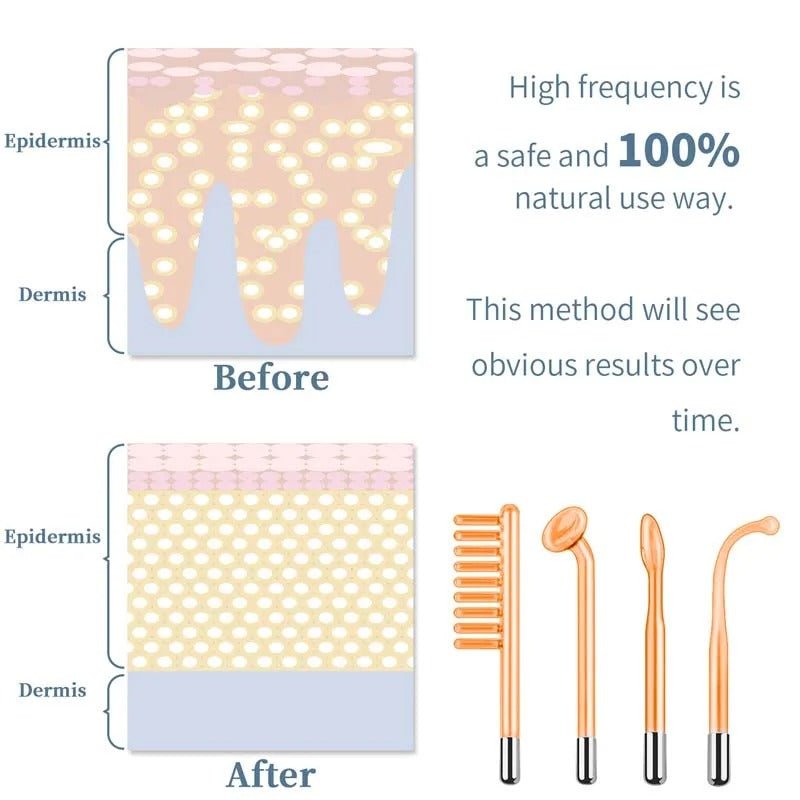 High Frequency Skin Therapy Wand – Portable Handheld Device - Onlytenbucks.com